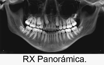 Centro Radiológico Dental San Diego radiografía facial 17