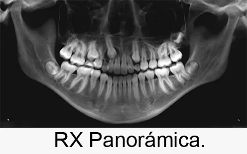 Centro Radiológico Dental San Diego radiografía facial 17