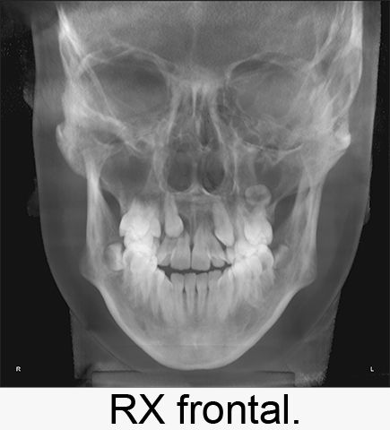 Centro Radiológico Dental San Diego radiografía facial 14