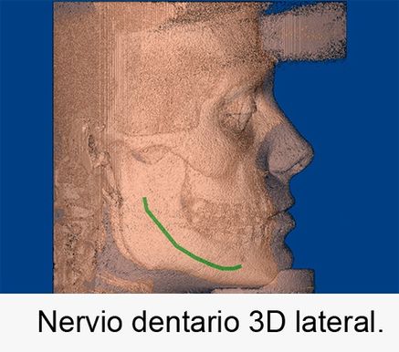 Centro Radiológico Dental San Diego radiografía facial 7