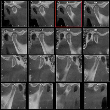 Centro Radiológico Dental San Diego radiografía