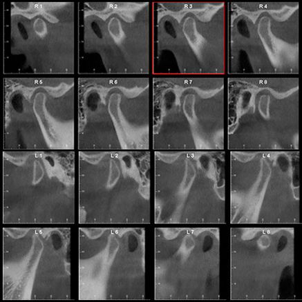 Centro Radiológico Dental San Diego radiografía facial 1