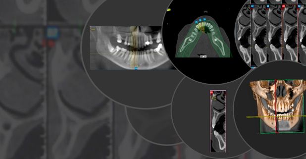 Centro Radiológico Dental San Diego radiografía maxilar 