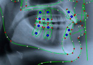 Centro Radiológico Dental San Diego radiografía facial 18
