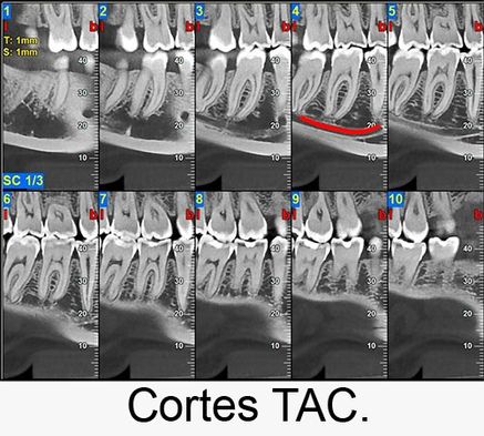 Centro Radiológico Dental San Diego radiografía facial 2