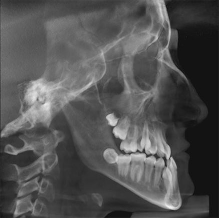 Centro Radiológico Dental San Diego radiografía facial 12