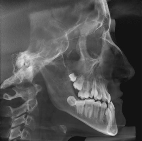 Centro Radiológico Dental San Diego radiografía facial 12