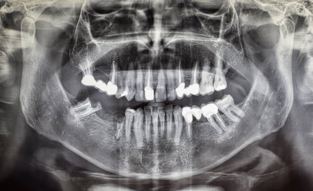 Radiografía dental 