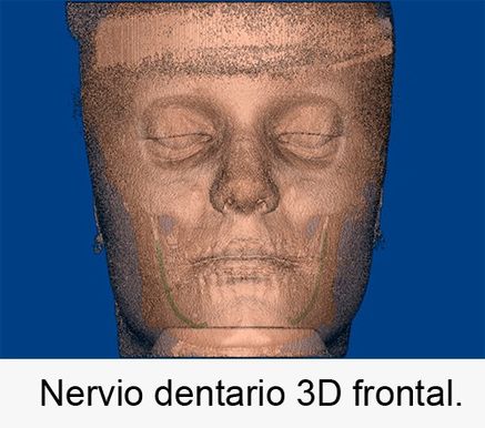 Centro Radiológico Dental San Diego radiografía facial 6