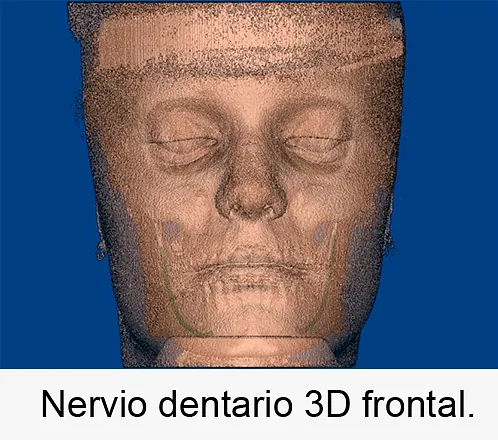 Centro Radiológico Dental San Diego radiografía facial 6