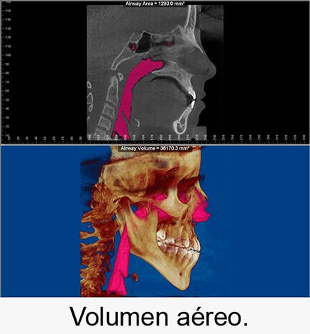 Centro Radiológico Dental San Diego radiografía facial 19