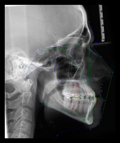 Centro Radiológico Dental San Diego radiografía facial 13