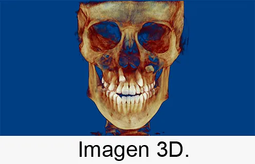 Centro Radiológico Dental San Diego radiografía facial 3