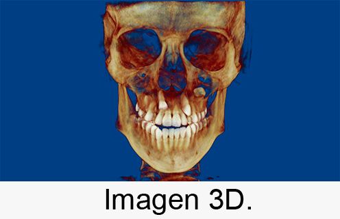 Centro Radiológico Dental San Diego radiografía facial 3