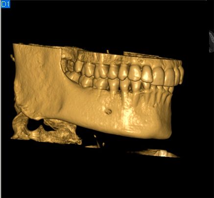 Centro Radiológico Dental San Diego radiografía facial 4