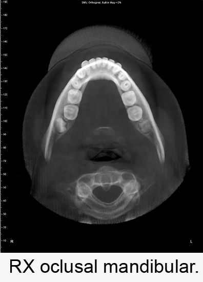 Centro Radiológico Dental San Diego radiografía facial 16