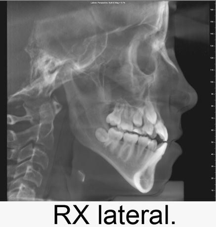 Centro Radiológico Dental San Diego radiografía facial 15