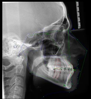 Centro Radiológico Dental San Diego radiografia de un cráneo 