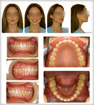 Centro Radiológico Dental San Diego fotografías dentales 